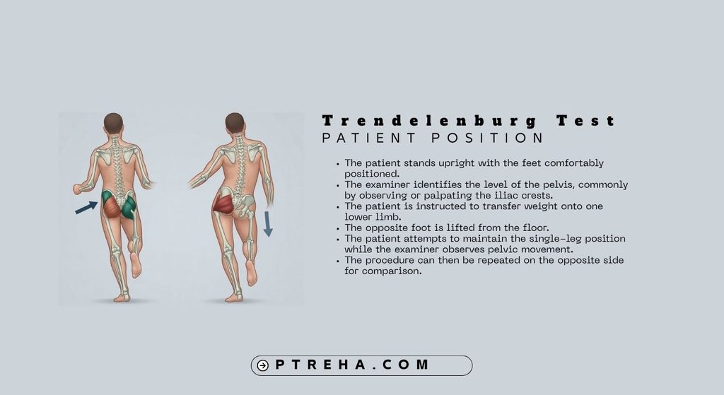 Trendelenburg Trendelenburg