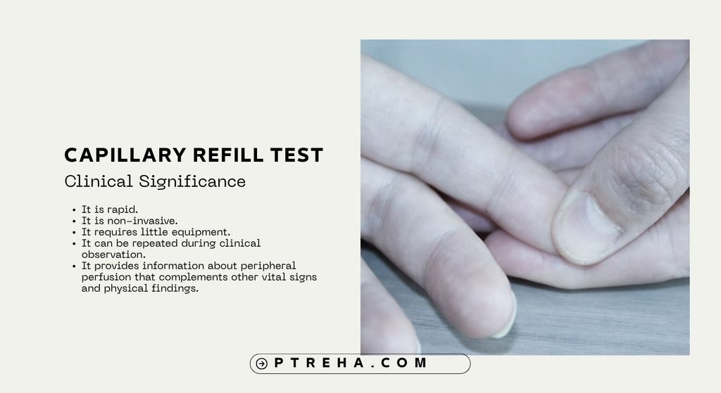 Capillary Refill Test