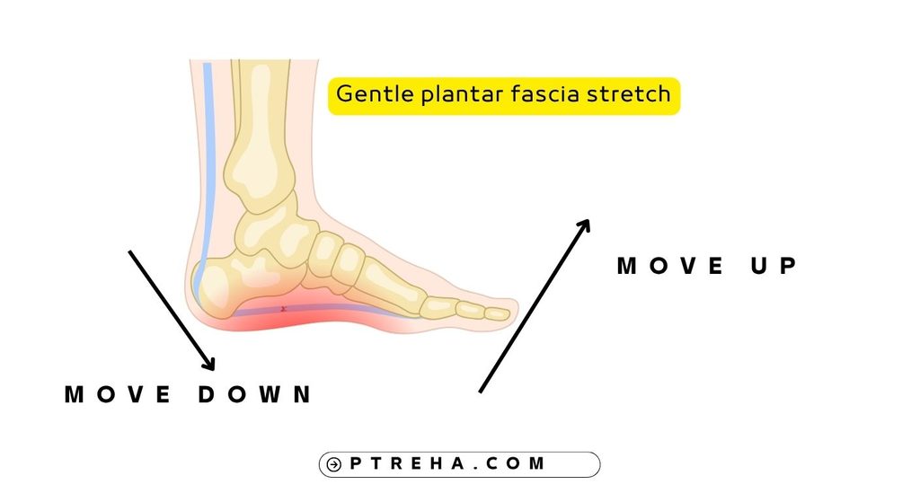 Plantar fasciitis Plantar fasciitis