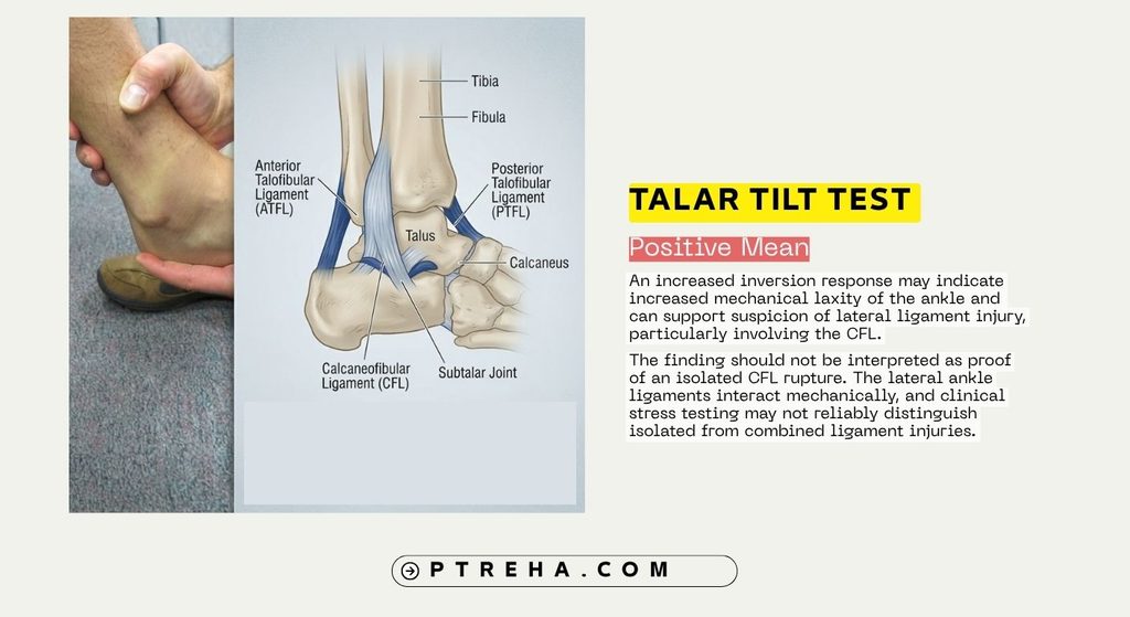 Talar Tilt Test Talar Tilt Test