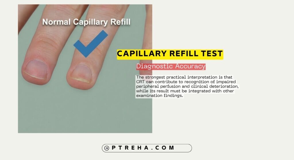 Capillary Refill Test