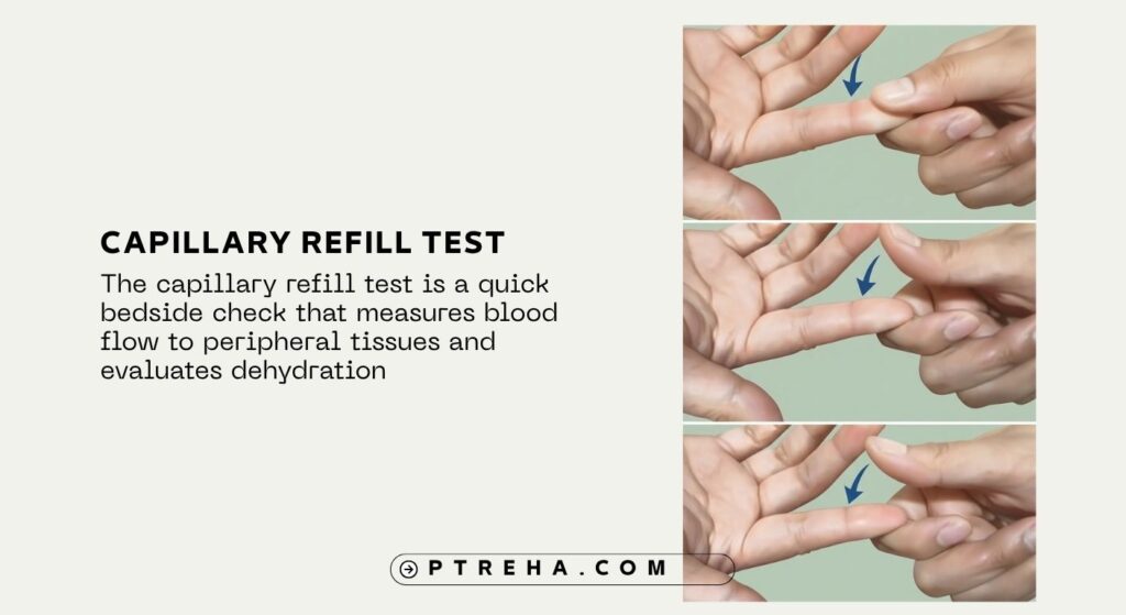 Capillary Refill Test