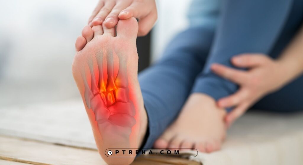 Plantar fasciitis Plantar fasciitis