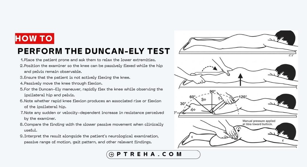 Duncan-Ely Test Duncan-Ely Test