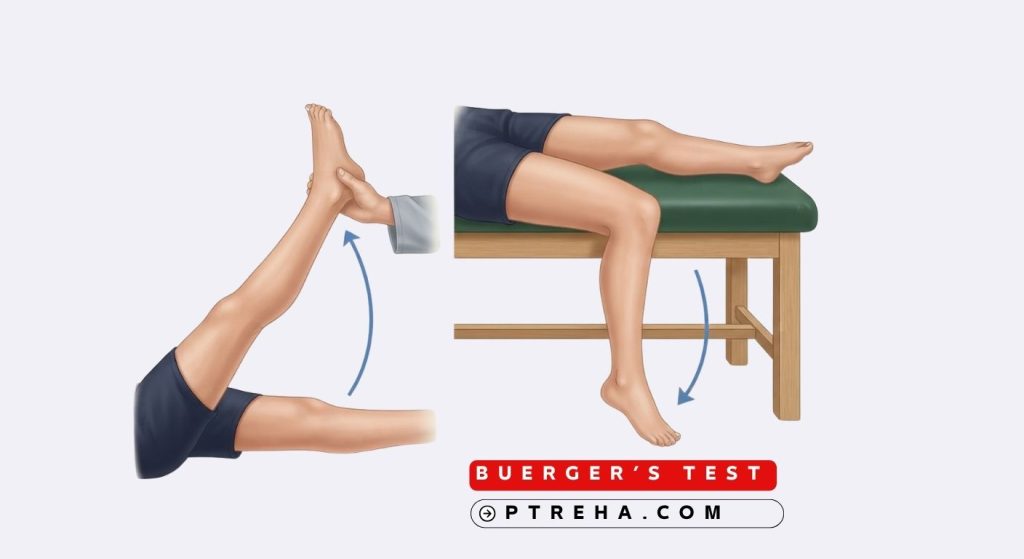 Buerger's Test Buerger's Test