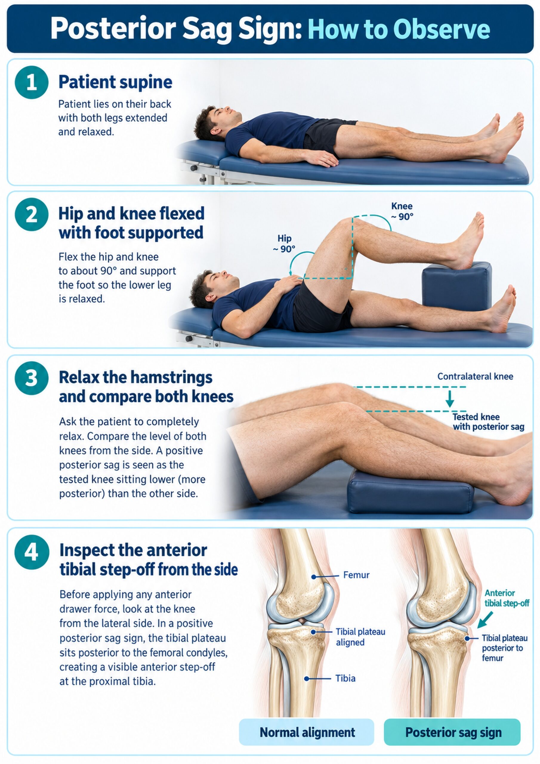 Step-by-step Posterior Sag Sign patient position and observation procedure