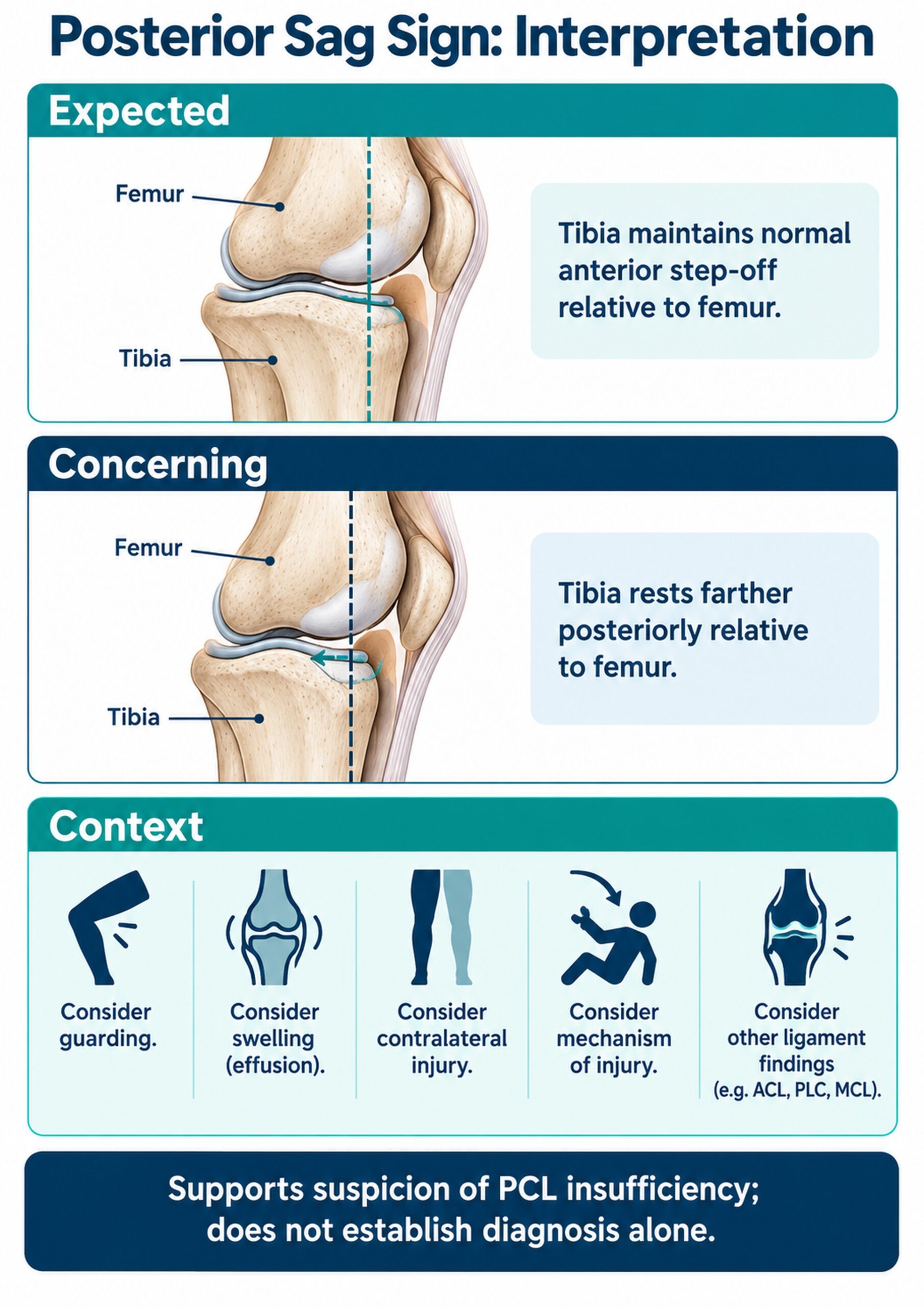 Comparison of expected tibial alignment and posterior tibial sag with clinical context