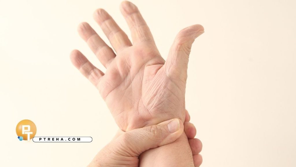 Wrist Fracture Wrist Fracture