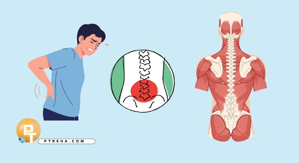 Back pain