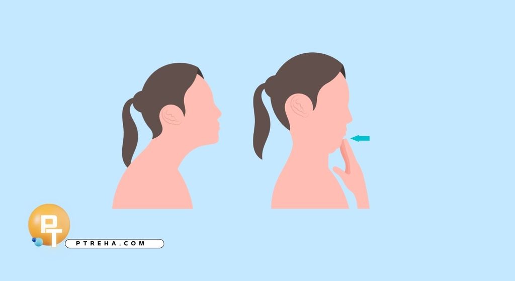 neck pain