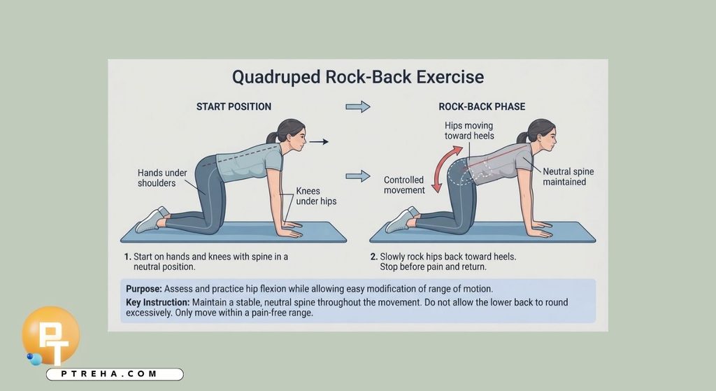 Hip impingement