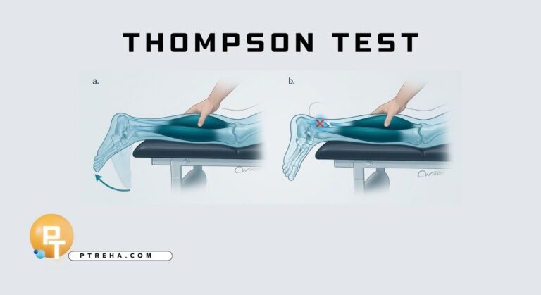 Thompson Test