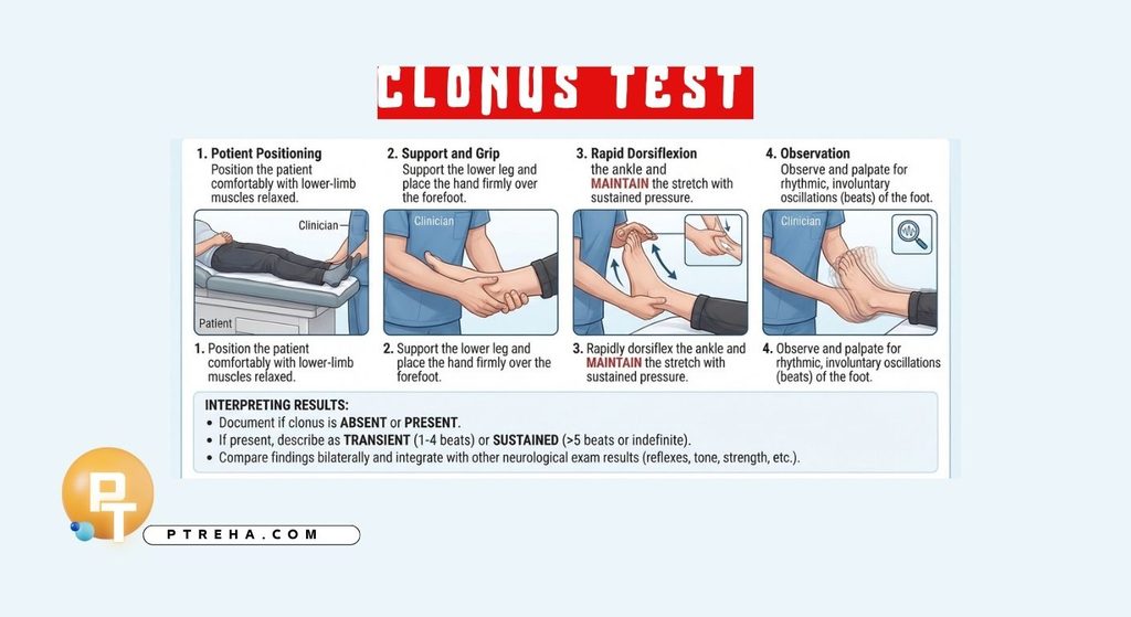 Clonus Test