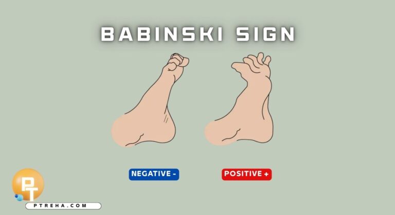 Babinski Sign