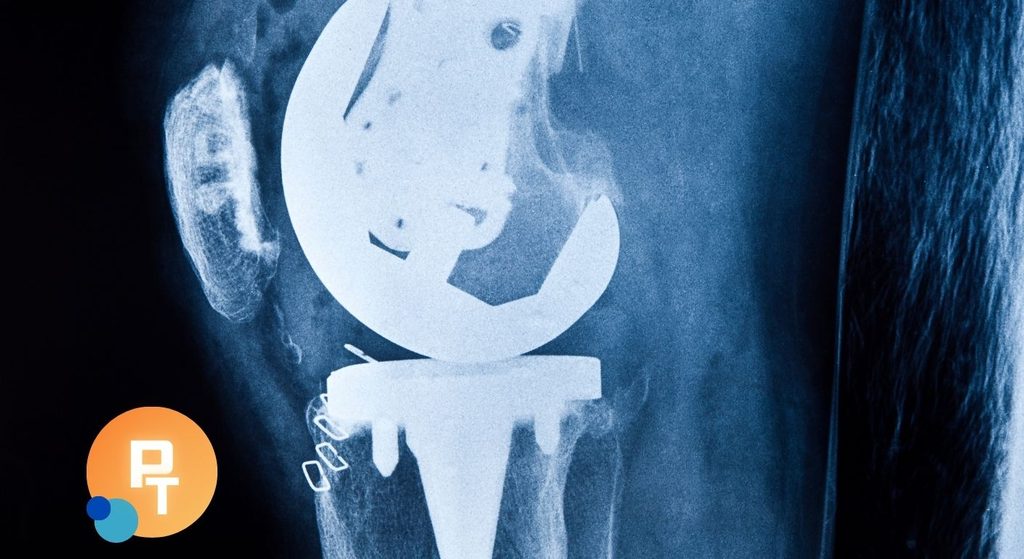 Knee Replacement Rehab