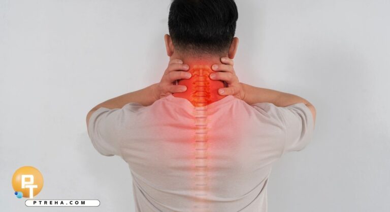 radiculopathy