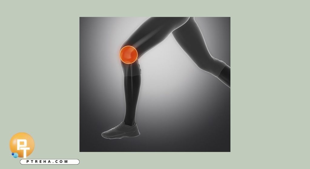 Meniscus Meniscus
