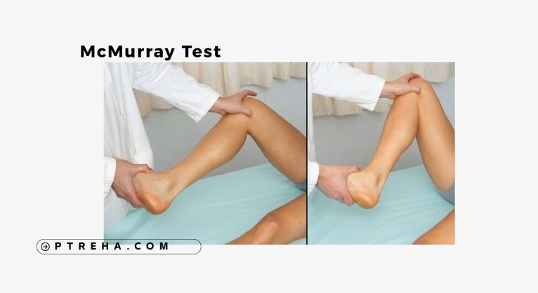 mcmurray test