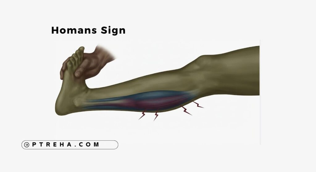 Homans Sign Homans Sign