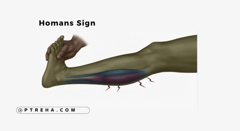 Homans Sign
