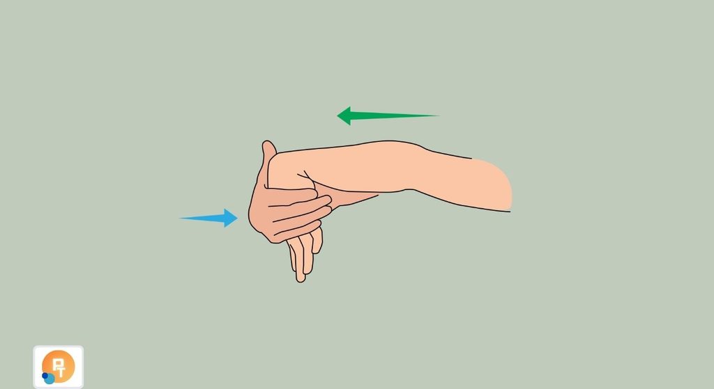 Golfer’s Wrist Golfer’s Wrist