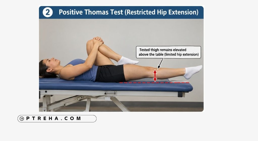 Thomas Test Thomas Test